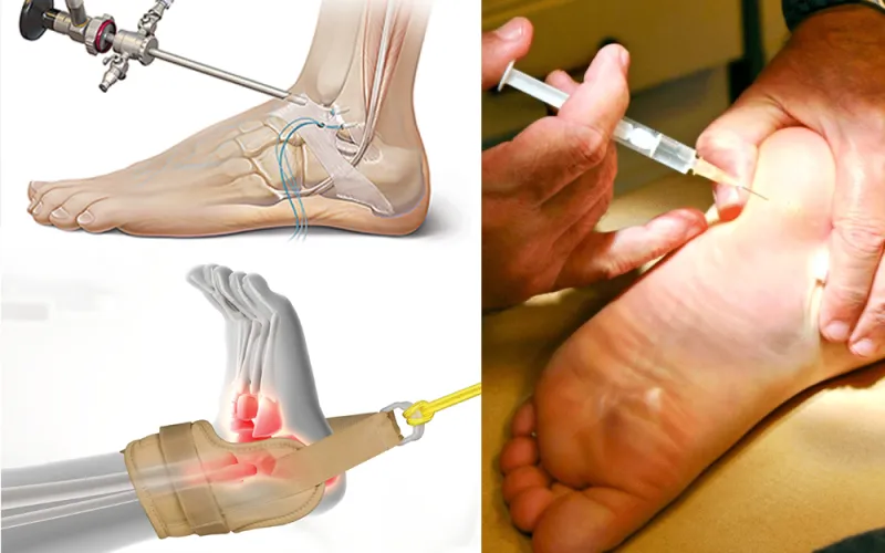 25w51 A PLANTAR advertorial 3 C US