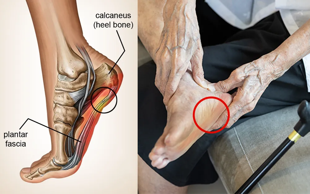 25w51 A PLANTAR advertorial 8 C US