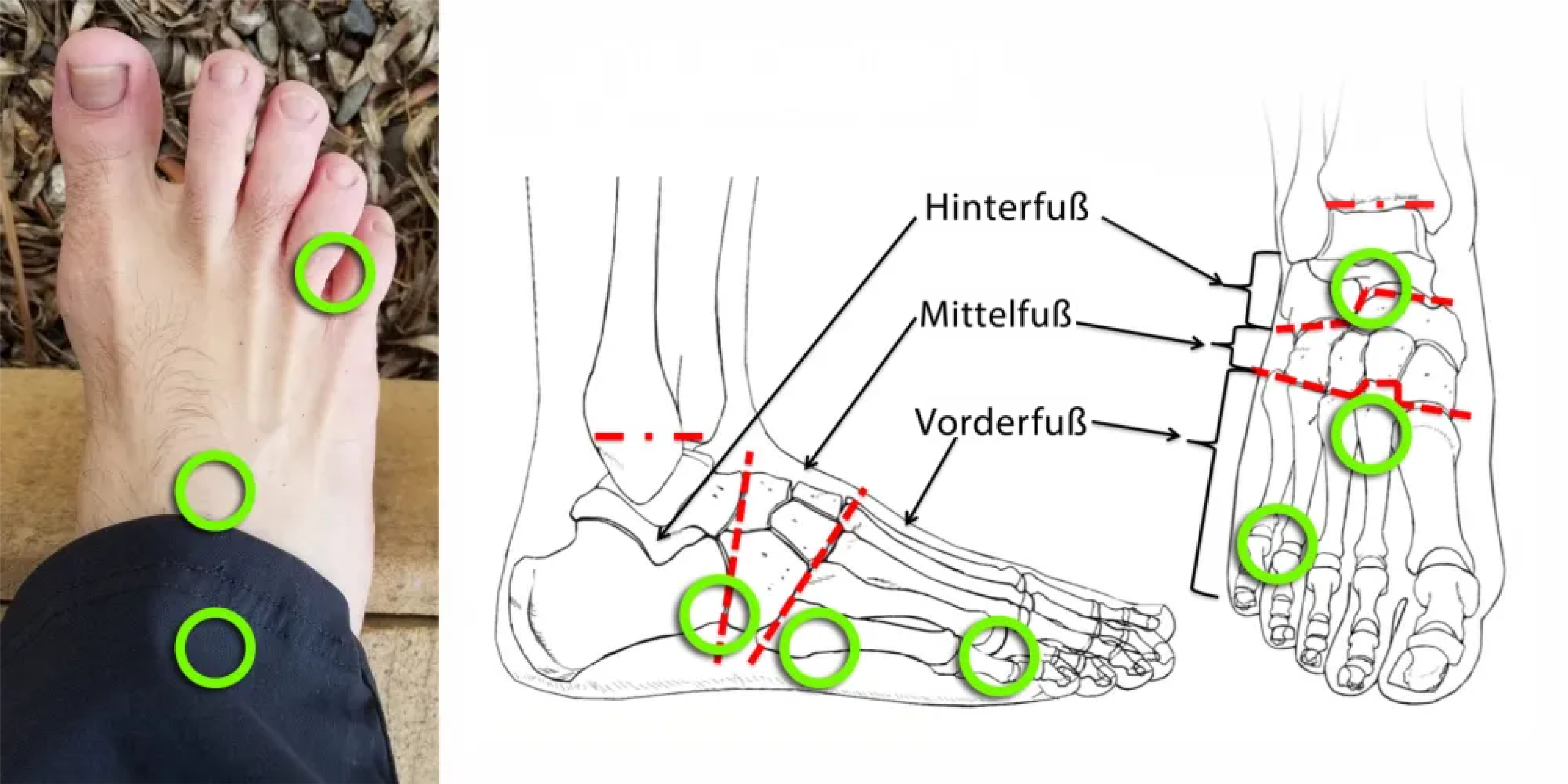 Akusoli 3 foot points DE C SM